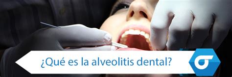 La Alveolitis Dental Diferentes Causas Tipos Y Tratamiento