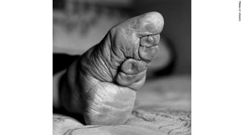 Last Living Women With Bound Feet