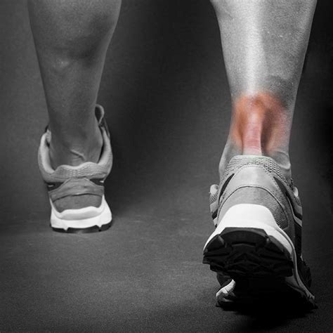 Tendonitis that affects the insertion of the tendon can occur at any time, even for insertional achilles tendonitis, blood flow is the most critical element in rapid recovery. Achilles Tendinitis and Compartment Syndrome | Run and ...