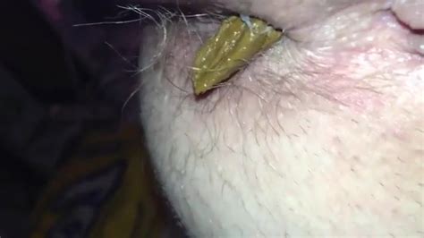 Close Up Soft Poop Scat Porn At Thisvid Tube