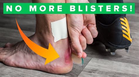 How To Tape Fingers For Climbing Blisters Important Facts