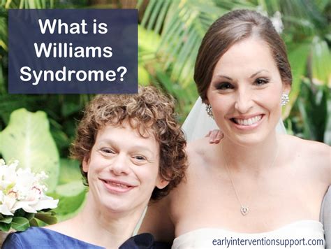 Williams Syndrome Facials What Is Williams Syndrome Telegraph
