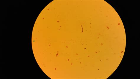 Are There Gram Negative Bacilli With Endospores Or Are