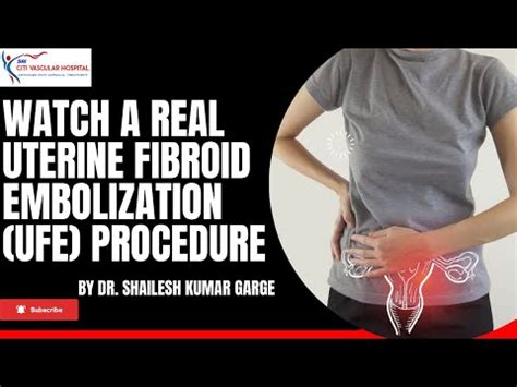 Uterine Fibroid Watch A Real Uterine Fibroid Embolization Procedure Citi Vascular Centre HYD