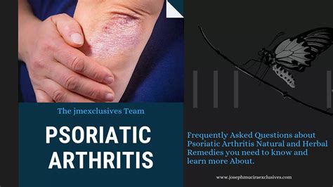 Psoriatic Arthritis Everything You Should Know About It Jmexclusives