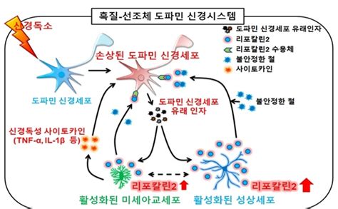 김광수 하버드대 교수, 파킨슨병 치료 세계 최초 성공. 파킨슨병 치료 치료제 치료비 증상