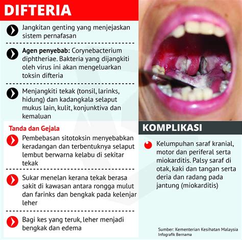 La difteria es una enfermedad causada por el efecto de la exotoxina de las cepas toxigénicas de c. Kerabu Corner: Infografik: Maklumat mengenai penyakit Difteria