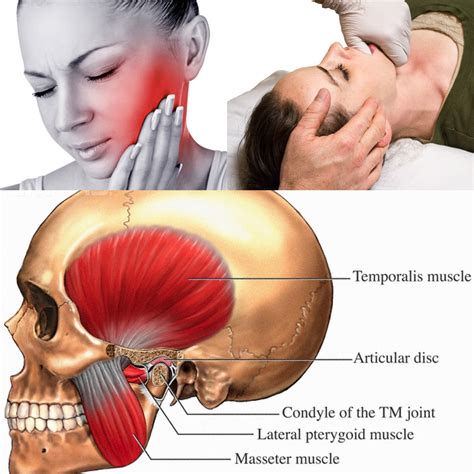 Tmj Relief — Serota Massage Therapy