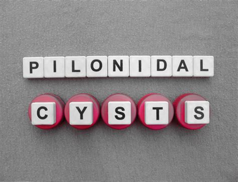 Pilonidal Cyst Causes Symptoms Removal And Treatments Advanced