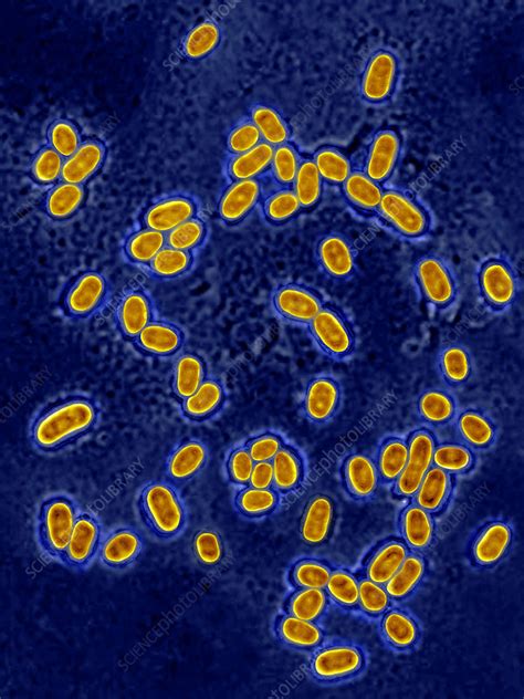 Streptococcus Pneumoniae Stock Image C0214488 Science Photo Library