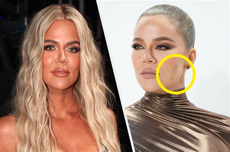 Khloé Kardashian Explained Why Shes Still Wearing A Band Aid Months