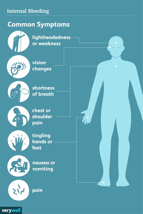 Internal Bleeding Signs Symptoms And Complications