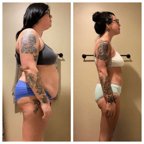 Perri Celebrates Her Transformation One Year After Weight Loss Surgery — Prime Surgicare
