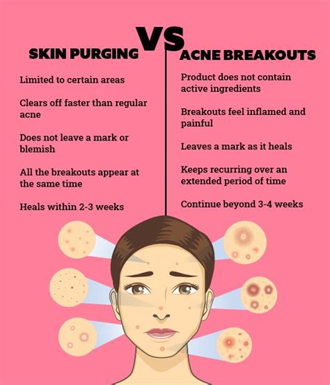 How To Identify And Treat Skin Purging According To A Dermatologist 2023