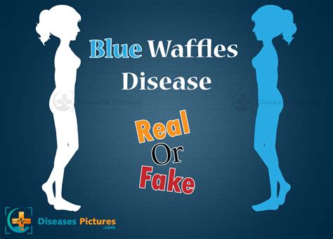 What Is A Blue Waffle Disease Real Or Fake Is Blue Waffles Disease A