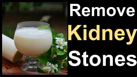 01/10natural remedies for kidney stones. Remove Kidney Stones Naturally With This Miracle Drink ...