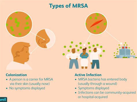 Mrsa Representation Of The Impact Of Barriers Contact Isolation On