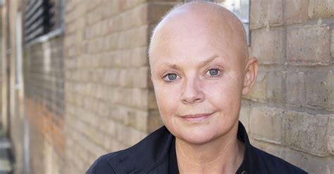 Gail Porter S Heartbreaking Explanation For How Her Naked Image Ended
