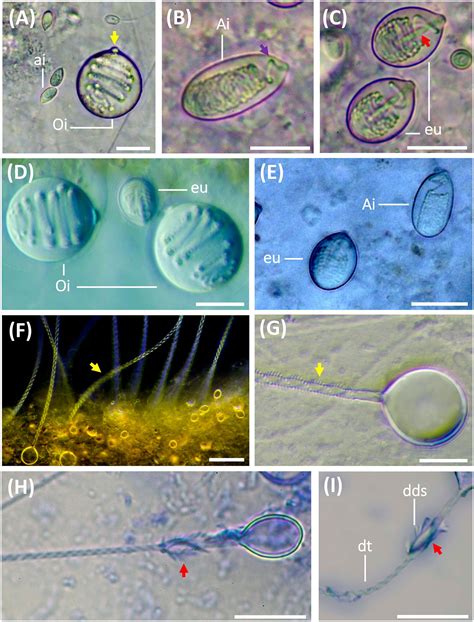 Frontiers Cnidome And Morphological Features Of Pelagia Noctiluca