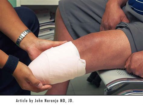 Ask Dr John Esq About Prosthetics Diller Law Personal Injury Law