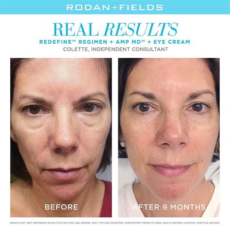 Rodan Fields Before And After Photos Rodan And Fields Redefine