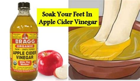 Soak Your Feet In Apple Cider Vinegar The Results Will Amaze You