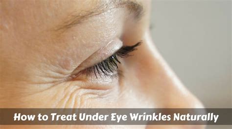 How To Treat Under Eye Wrinkles Naturally
