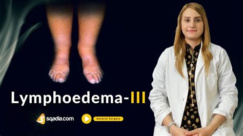 Lymphoedema Iii Surgery Video Lectures Medical Student Online