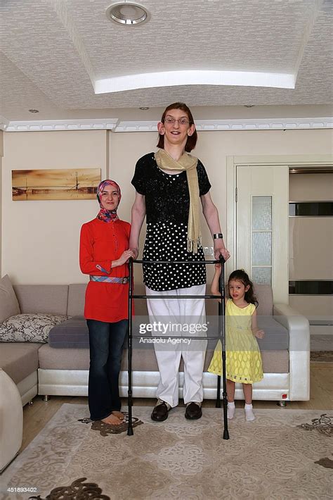Rumeysa Gelgi Granted As The Worlds Tallest Girl With Her 213 Meter