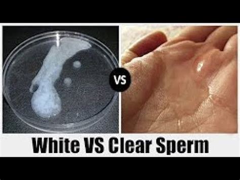 Difference Between White And Clear Sperm Health Care Youtube