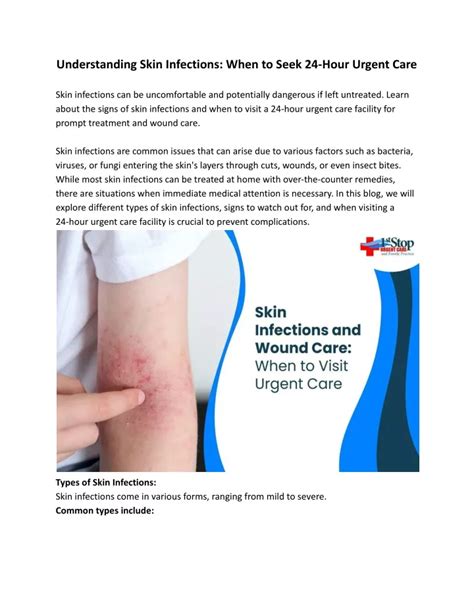 Ppt Skin Infections And Wound Care When To Visit Urgent Care