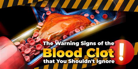 The Warning Signs Of The Blood Clot That You Shouldnt Ignore