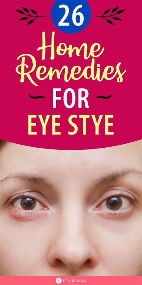 26 effective home remedies to get rid of eye stye in 2021 home remedies remedies natural