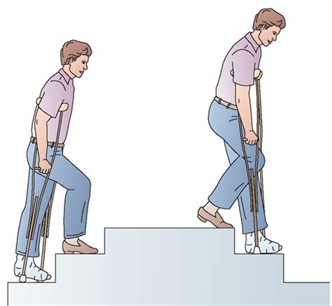 The vast majority of stairway falls result from a loss of balance, just as falls are on the level. Crutch Walking & Adjustment