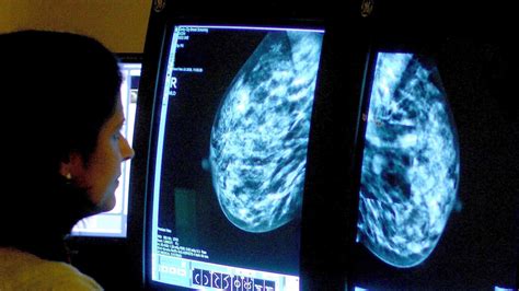 Genetic Test May Lead To More Effective Chemotherapy For Deadly Breast Cancer Bt