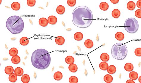 Chronic Eosinophilic Leukemia Storymd