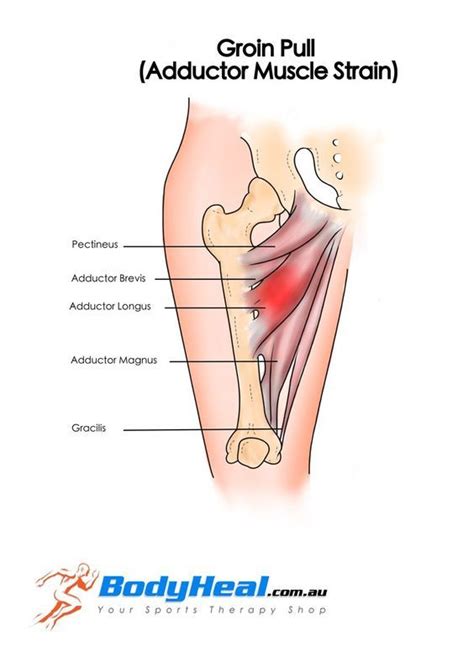 The anatomy of the pectineus muscle. Pin on Human Anatomy Drawing