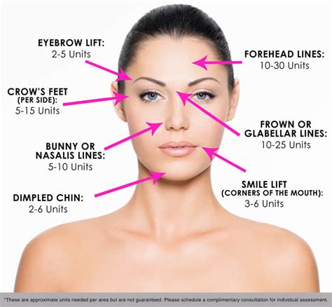 Botox Injection Sites Chart Images And Photos Finder
