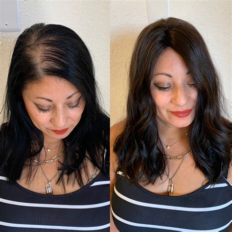 Crown Toppers Solutions For Top Thinning Hair — Spg Extensions And Color