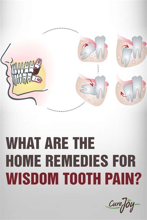 How To Reduce Wisdom Teeth Swelling And Pain Fris Bee