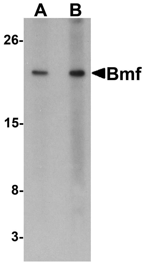 Ihc Plus™ Bmf Polyclonal Antibody Rabbit Anti Human Lsbio