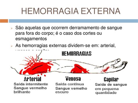 Hemorragia E A Perda De Sangue Em Virtude Do Rompimento