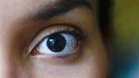 This Subtle Eye Issue Could Cause Headaches And Double Vision