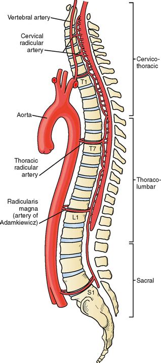 Spinal Cord Infarction Clinical Gate