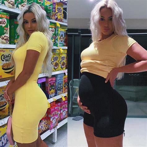 Instagram Model Shocks With Hour Bloating Transformation Photo