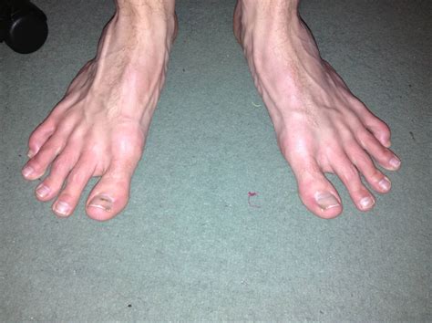 Can You Guess Whos Famous Feet These Are Love Is Afoot A Musical