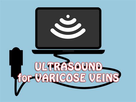 Ultrasound For Varicose Veins Denver Vein Center