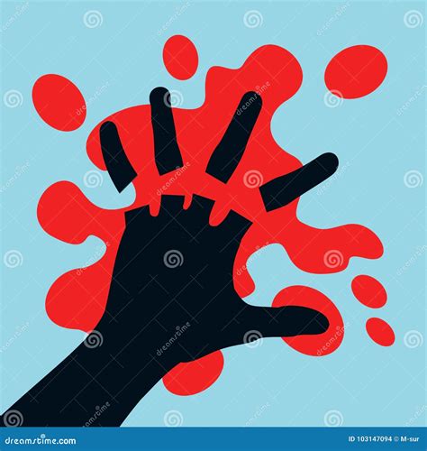 Cut Off Fngers Stock Vector Illustration Of Chop Medical 103147094