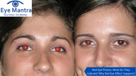 Red Eye Effect What Do They Indicate What Causes Red Eye In Photos