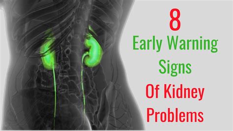 Early Warning Signs Of Kidney Problems Youtube